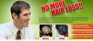 Hiroko Kobayashi - Japanese Miracle hair regrowth manual Do it Yourself 2 Min a Day